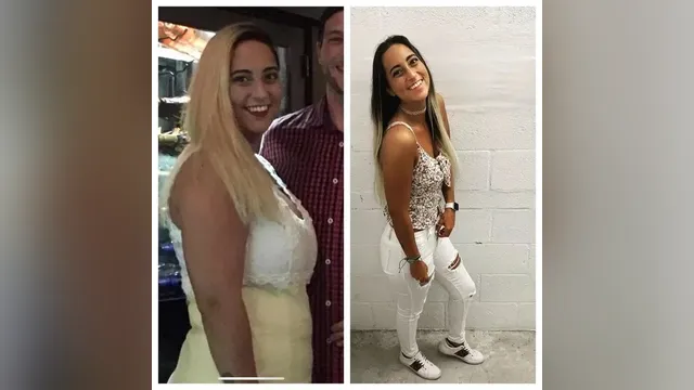 Before and after photo of a Healthy Weight Loss 4 U patient; individual results vary