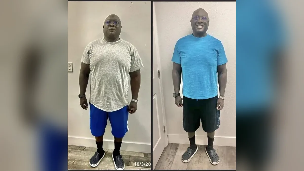 Before and after photo of a Healthy Weight Loss 4 U patient; individual results vary