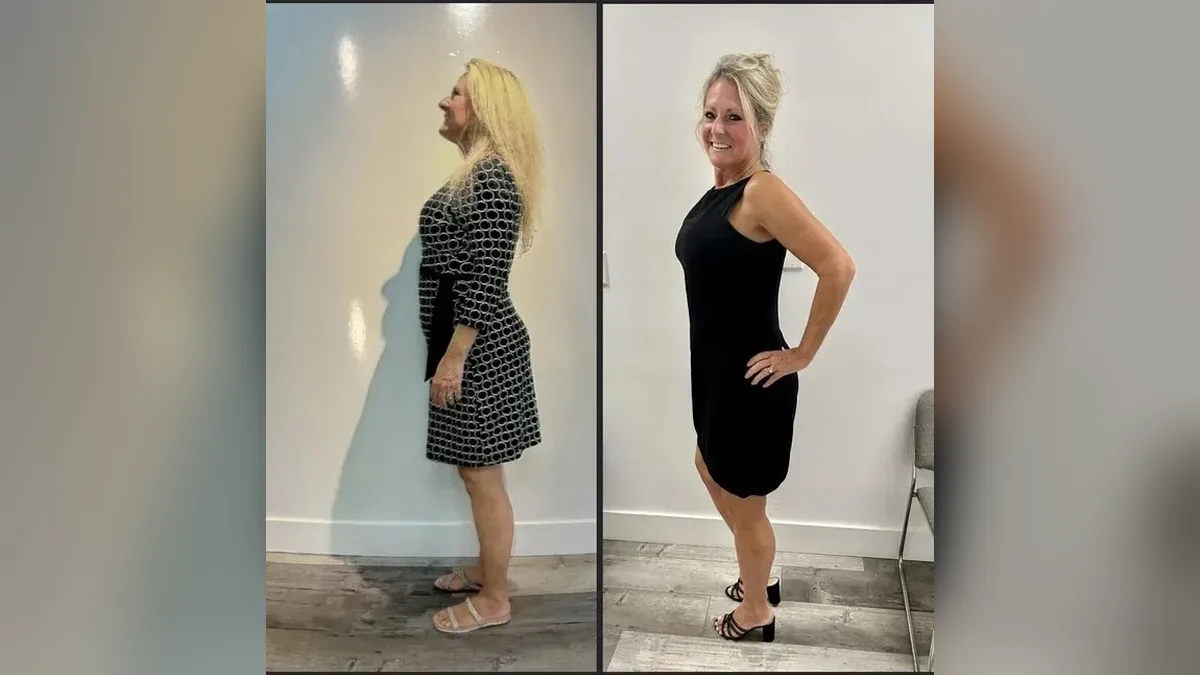 Before and after photo of a Healthy Weight Loss 4 U patient; individual results vary