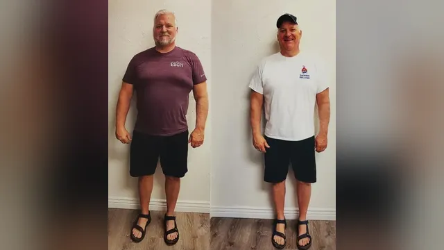 Before and after photo of a Healthy Weight Loss 4 U patient; individual results vary