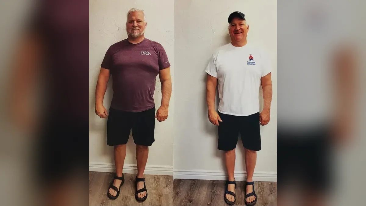Before and after photo of a Healthy Weight Loss 4 U patient; individual results vary