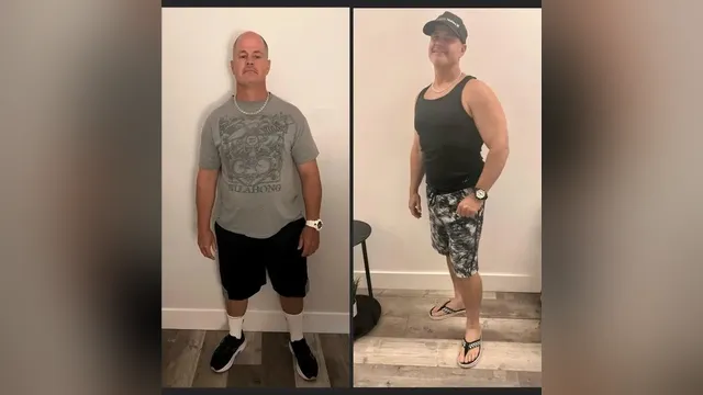 Before and after photo of a Healthy Weight Loss 4 U patient; individual results vary
