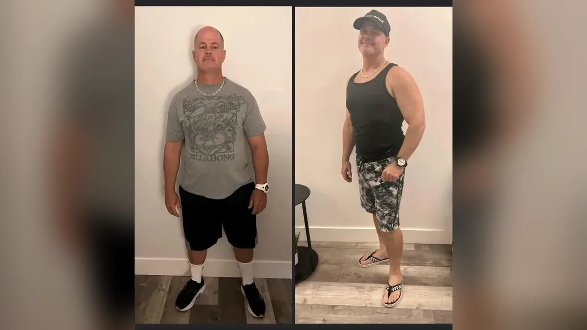 Before and after photo of a Healthy Weight Loss 4 U patient; individual results vary