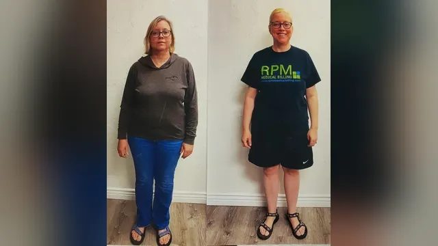 Before and after photo of a Healthy Weight Loss 4 U patient; individual results vary