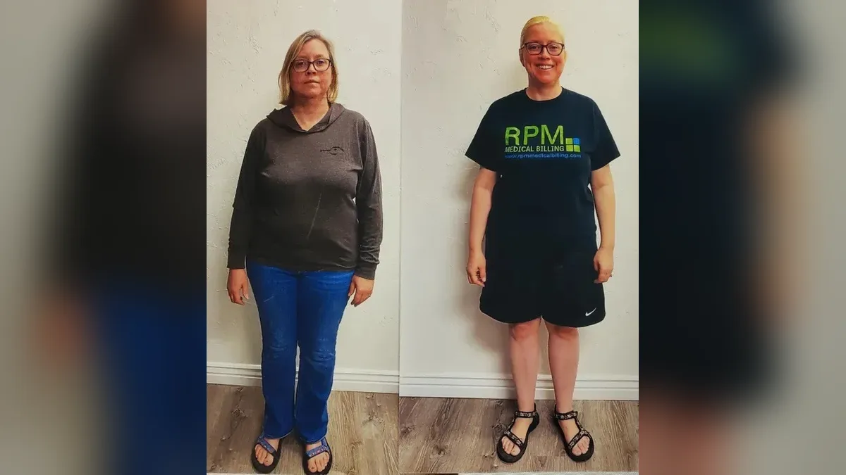 Before and after photo of a Healthy Weight Loss 4 U patient; individual results vary