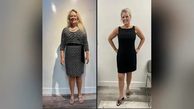 Before and after photo of a Healthy Weight Loss 4 U patient; individual results vary