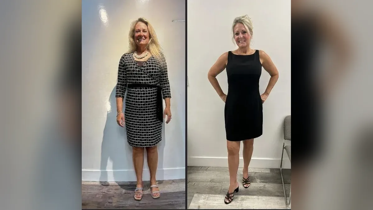 Before and after photo of a Healthy Weight Loss 4 U patient; individual results vary