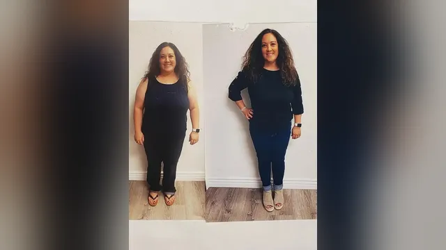 Before and after photo of a Healthy Weight Loss 4 U patient; individual results vary