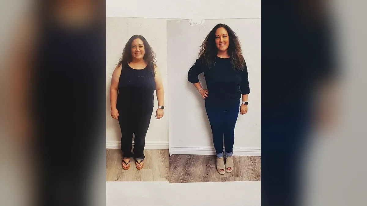 Before and after photo of a Healthy Weight Loss 4 U patient; individual results vary