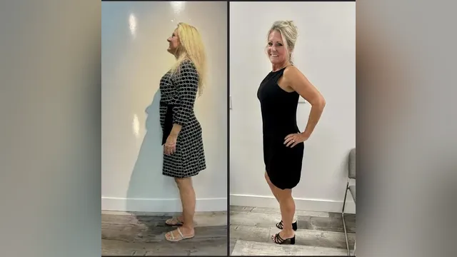 Before and after photo of a Healthy Weight Loss 4 U patient; individual results vary
