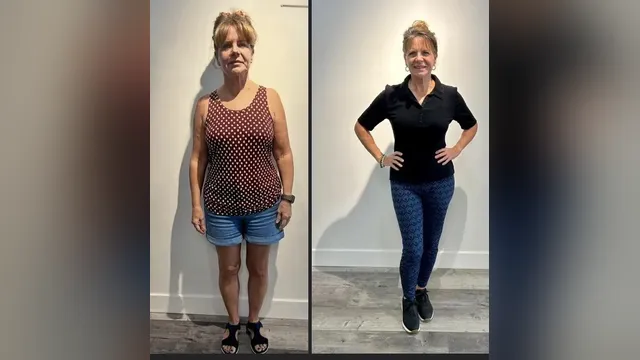 Before and after photo of a Healthy Weight Loss 4 U patient; individual results vary