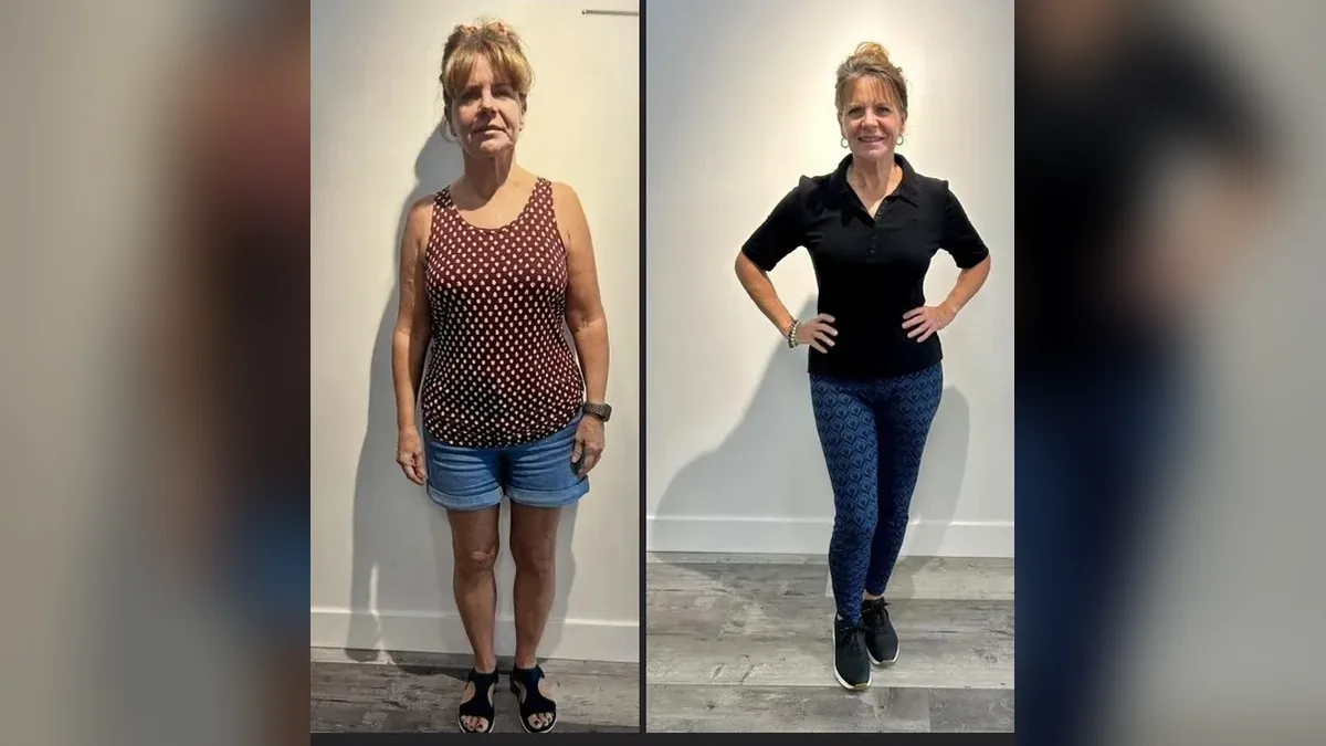 Before and after photo of a Healthy Weight Loss 4 U patient; individual results vary