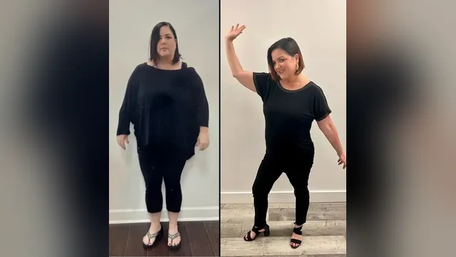 Before and after photo of a Healthy Weight Loss 4 U patient; individual results vary