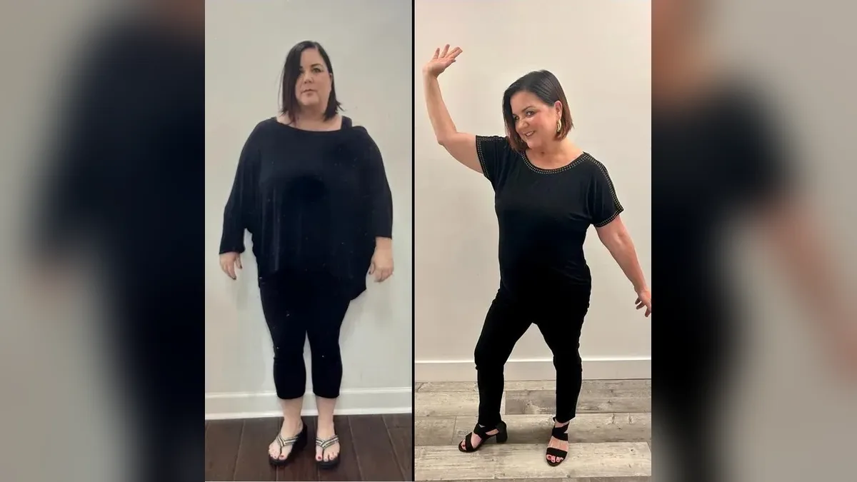 Before and after photo of a Healthy Weight Loss 4 U patient; individual results vary