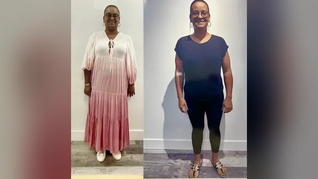 Before and after photo of a Healthy Weight Loss 4 U patient; individual results vary
