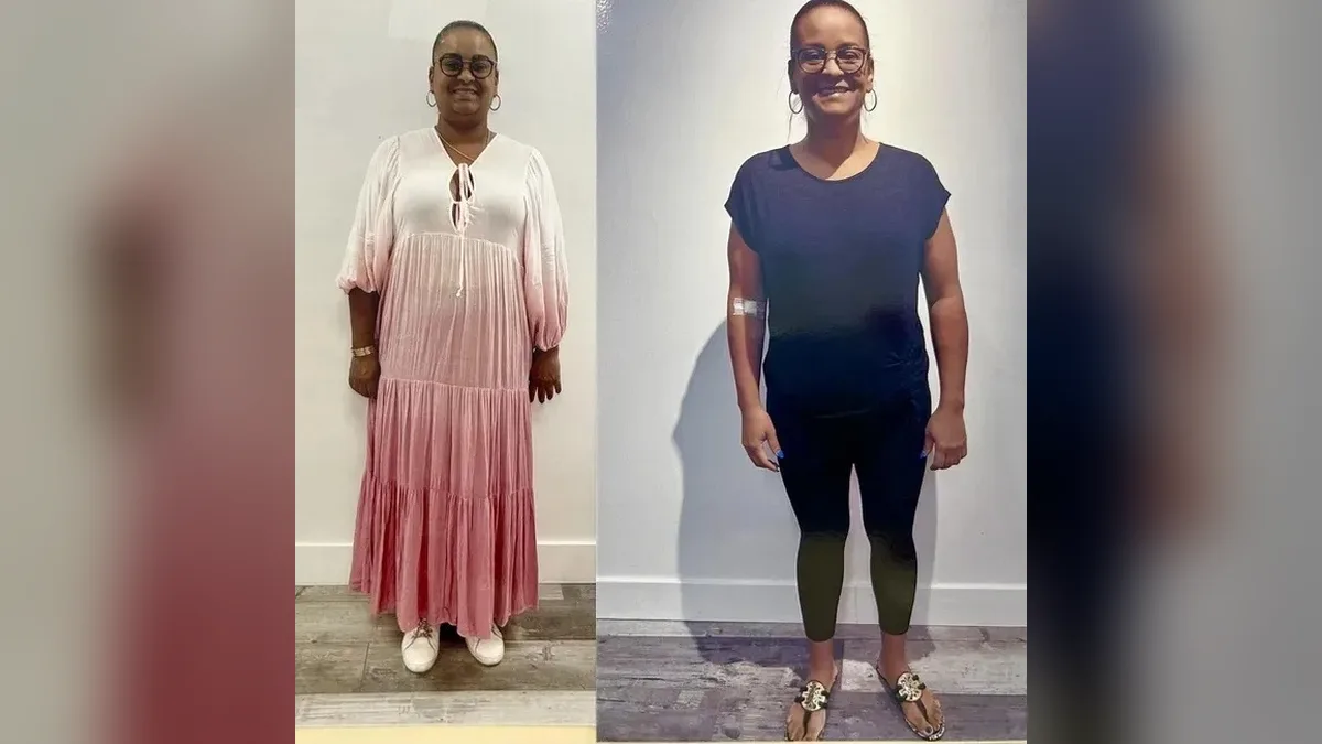 Before and after photo of a Healthy Weight Loss 4 U patient; individual results vary