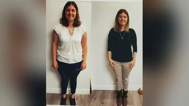 Before and after photo of a Healthy Weight Loss 4 U patient; individual results vary