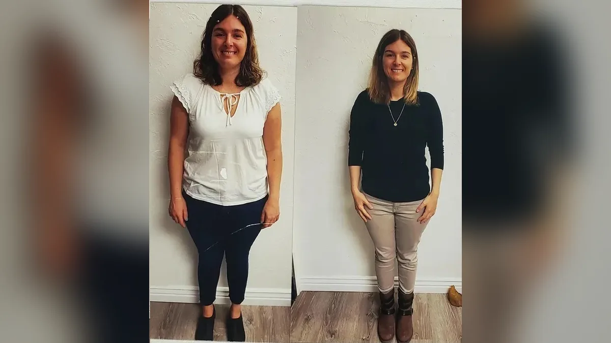 Before and after photo of a Healthy Weight Loss 4 U patient; individual results vary