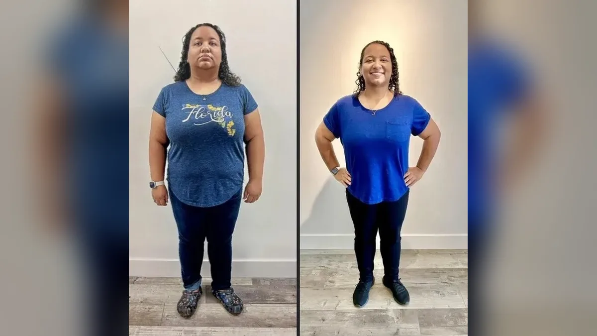Before and after photo of a Healthy Weight Loss 4 U patient; individual results vary