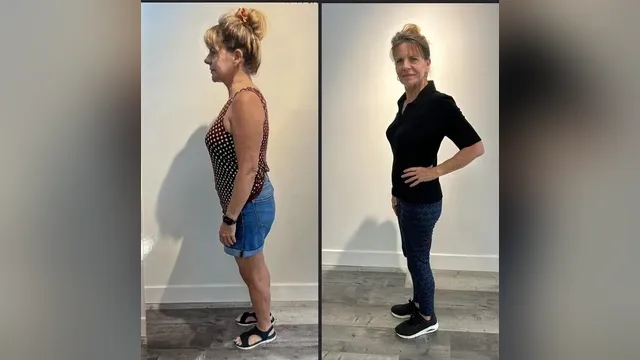 Before and after photo of a Healthy Weight Loss 4 U patient; individual results vary