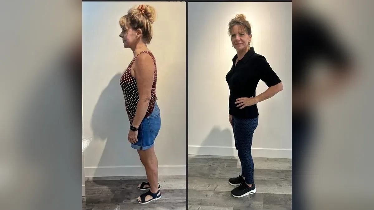 Before and after photo of a Healthy Weight Loss 4 U patient; individual results vary