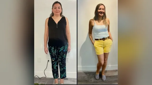 Before and after photo of a Healthy Weight Loss 4 U patient; individual results vary