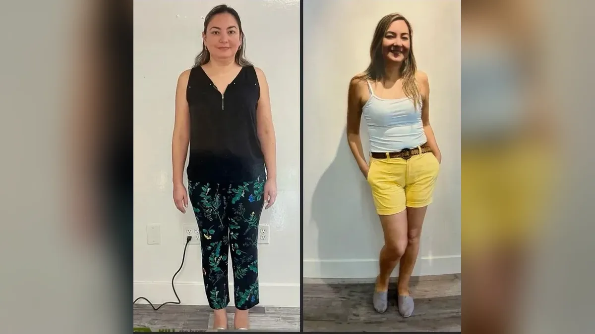 Before and after photo of a Healthy Weight Loss 4 U patient; individual results vary